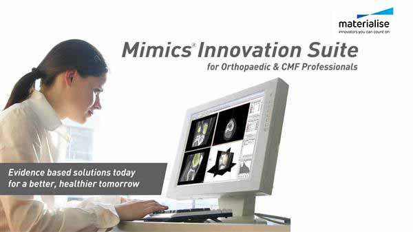 Materialise 发布新版Mimics软件