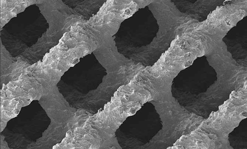德国首例3D打印钛脊柱成功融合植入手术