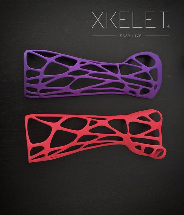 兼具舒适性和功能性的3D打印骨折固定夹板