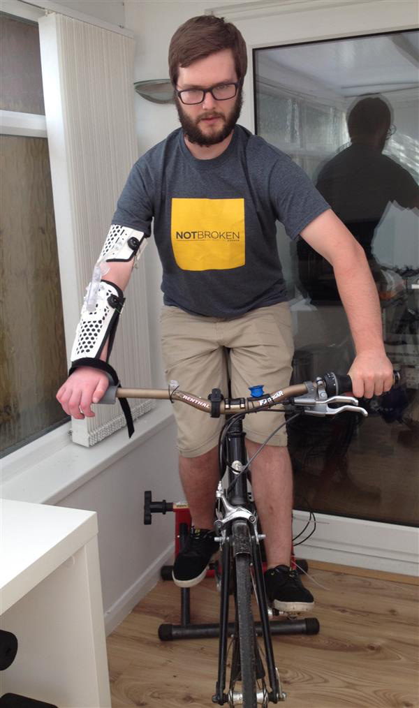 3D打印帮助右臂瘫痪的顽强山地车手重返赛场