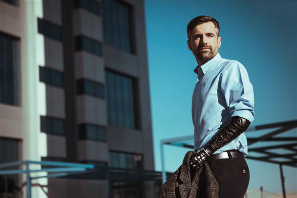 UNYQ推出美观时尚的3D打印定制假臂外壳