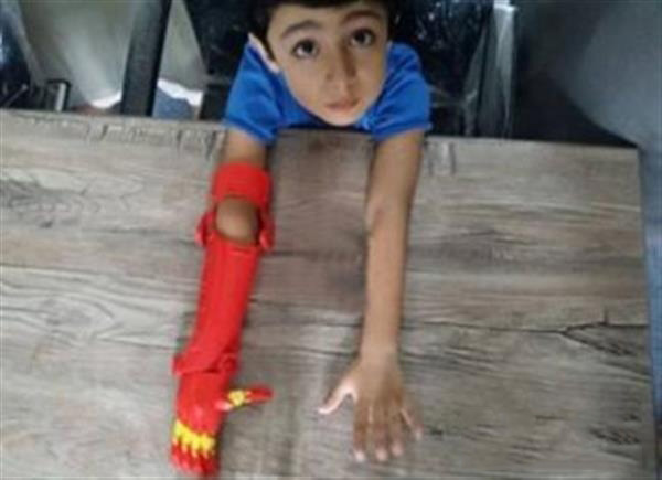 Bioniks为孩子们3D打印假肢“超级英雄”系列假肢