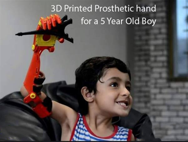 Bioniks为孩子们3D打印假肢“超级英雄”系列假肢