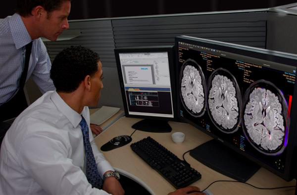 飞利浦发布其视觉分析和量化平台的最新版本