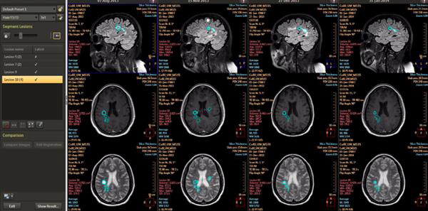 飞利浦发布其视觉分析和量化平台的最新版本