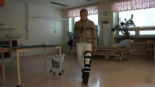 3D打印髋关节植入物让瑞典少女再次行走