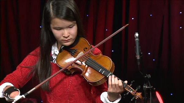 借助3D打印残疾演奏家有望实现更多动作