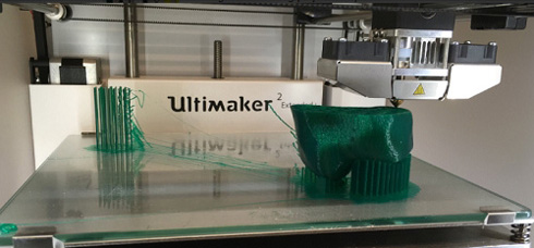 西班牙医院为推动医学发展引进3D打印技术