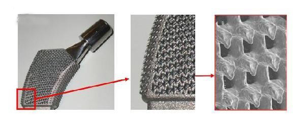 带数百个小爪的新3D打印骨植入物使用寿命更长