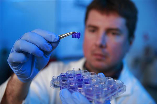 强生联手Aspect Biosystems开发3D打印膝关节软骨