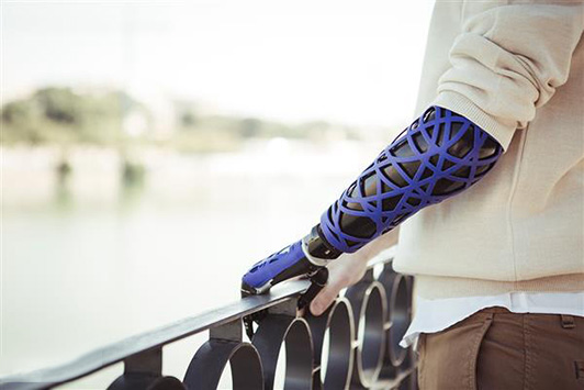 3D打印假体公司UNYQ在美国东海岸新增办公点