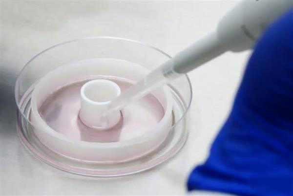 对抗心脏病的“环堆叠法”：用3D打印导板制作定制血管