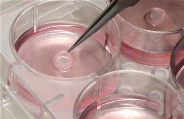 对抗心脏病的“环堆叠法”：用3D打印导板制作定制血管