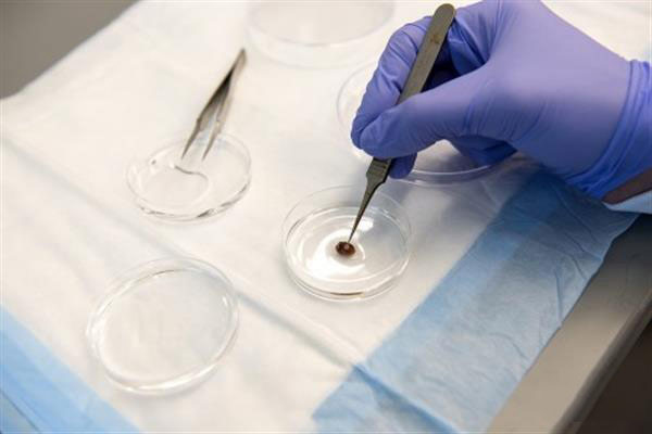 明尼苏达大学的3D生物打印补丁可修复受损的心脏细胞